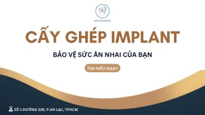 CẤY GHÉP IMPLANT – BẢO VỆ SỨC NHAI CỦA BẠN LÂU DÀI