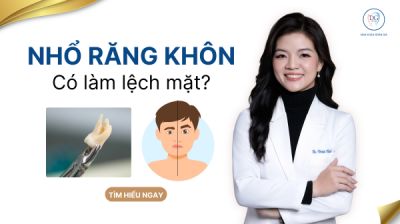 NHỔ RĂNG KH&Ocirc;N C&Oacute; BỊ LỆCH MẶT KH&Ocirc;NG ?