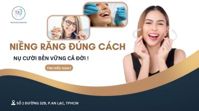 LƯU Ý KHI THÁO NIỀNG ĐỂ RĂNG KHÔNG BỊ CHẠY?
