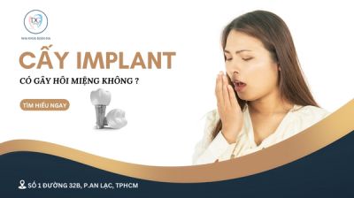 IMPLANT CÓ GÂY HÔI MIỆNG KHÔNG?