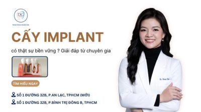 IMPLANT CÓ THẬT SỰ BỀN VỮNG SUỐT ĐỜI? GIẢI ĐÁP TỪ CHUYÊN GIA
