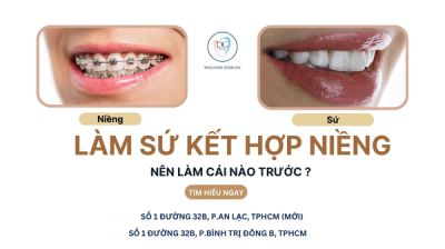 LÀM RĂNG SỨ KẾT HỢP NIỀNG – NÊN LÀM CÁI NÀO TRƯỚC?