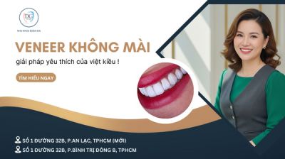 VENEER KHÔNG MÀI RĂNG – GIẢI PHÁP YÊU THÍCH CỦA PHỤ NỮ VIỆT KIỀU