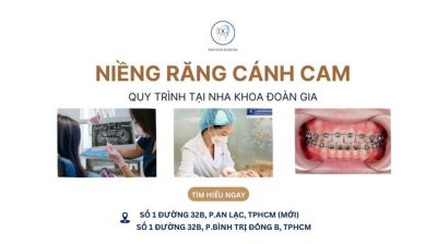 LỘ TRÌNH ĐIỀU TRỊ BẰNG NIỀNG MẮC CÀI CÁNH CAM TẠI NHA KHOA