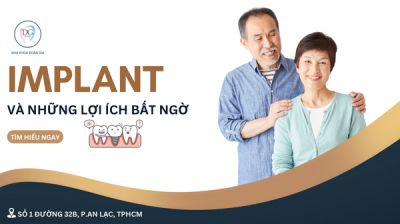 Implant và những lợi ích vượt trội bạn không nên bỏ lỡ