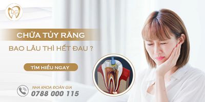 Chữa tủy răng bao lâu thì hết đau? Quy trình chữa tủy răng