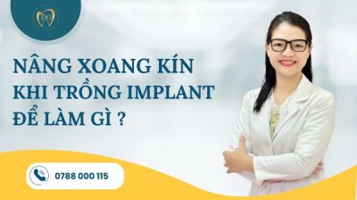 Vì sao cần nâng xoang kín trong cấy ghép implant?