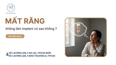 MẤT RĂNG HÀM SỐ 6 – KHÔNG LÀM IMPLANT CÓ SAO KHÔNG?