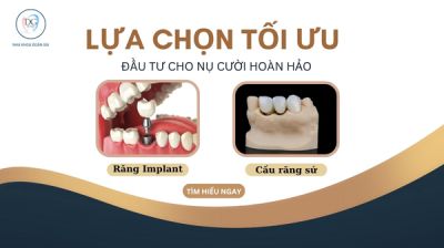 CẦU RĂNG SỨ VÀ IMPLANT LỰA CHỌN NÀO TỐT HƠN?