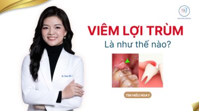VI&Ecirc;M LỢI TR&Ugrave;M L&Agrave; G&Igrave; ?