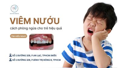 CÁCH PHÒNG NGỪA VIÊM NƯỚU Ở TRẺ EM HIỆU QUẢ