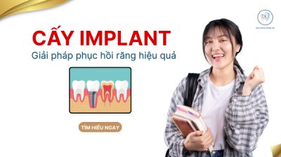 Cấy gh&eacute;p implant kh&ocirc;ng đau quận B&igrave;nh T&acirc;n &ndash; Giải ph&aacute;p phục hồi răng hiệu quả