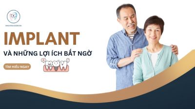 IMPLANT VÀ NHỮNG LỢI ÍCH VƯỢT TRỘI KHIẾN BẠN BẤT NGỜ