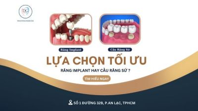 TRỒNG RĂNG IMPLANT KHÁC GÌ VỚI CẦU RĂNG SỨ