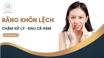 RĂNG KHÔN MỌC LỆCH?  CHẬM XỬ LÝ - ĐAU CẢ HÀM