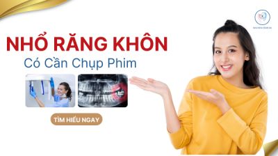 NHỔ RĂNG KH&Ocirc;N C&Oacute; CẦN CHỤP PHIM KH&Ocirc;NG ?