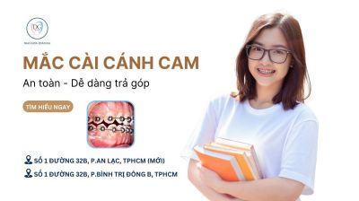 NIỀNG MẮC CÀI CÁNH CAM – AN TOÀN, NHẸ NHÀNG, DỄ DÀNG TRẢ GÓP