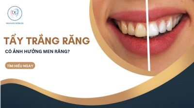 TẨY TRẮNG RĂNG ẢNH HƯỞNG MEN RĂNG ?