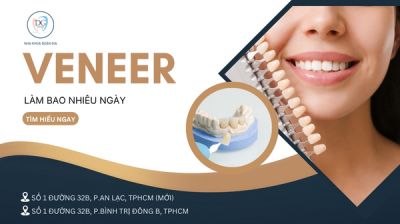 LÀM RĂNG VENEER VỀ NƯỚC CÓ KỊP TRONG 7 NGÀY KHÔNG?