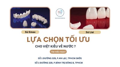 NÊN CHỌN SỨ EMAX HAY LISI CHO CA VIỆT KIỀU VỀ NƯỚC