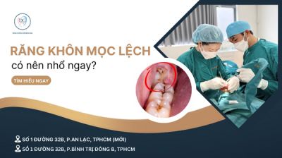 RĂNG KH&Ocirc;N MỌC LỆCH &ndash; CHỜ HAY NHỔ?