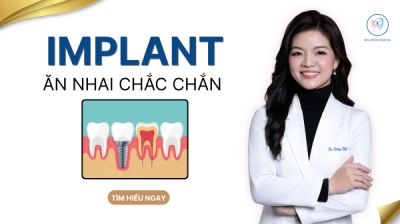 IMPLANT &ndash; ĂN NHAI CHẮC CHẮN, PHỤC HỒI RĂNG MẤT BỀN VỮNG