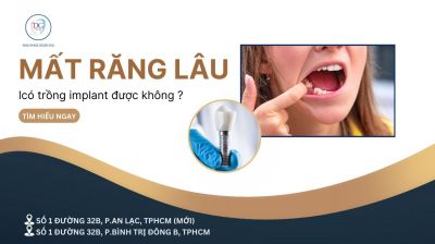 MẤT RĂNG LÂU NĂM CÓ TRỒNG IMPLANT ĐƯỢC KHÔNG?