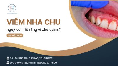 NGUY CƠ MẤT RĂNG VÌ CHỦ QUAN VIÊM NHA CHU