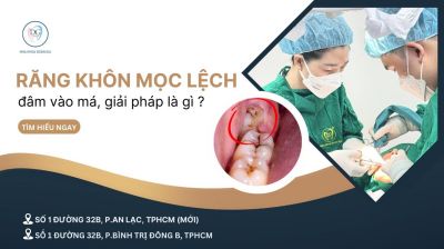RĂNG KHÔN MỌC LỆCH ĐÂM VÀO MÁ – GIẢI PHÁP NÀO LÀ AN TOÀN?