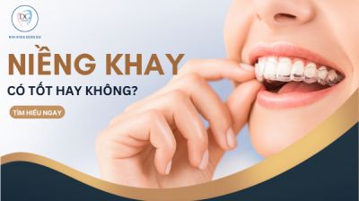 NIỀNG RĂNG TRONG SUỐT CÓ TỐT KHÔNG?