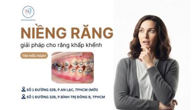 NIỀNG MẮC CÀI CÁNH CAM – GIẢI PHÁP TOÀN DIỆN CHO RĂNG KHẤP KHỂNH