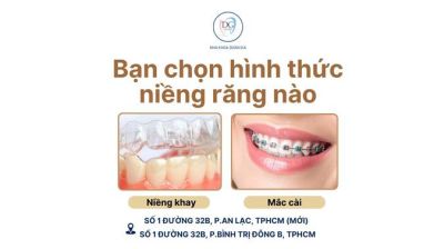 NIỀNG KHAY C&Oacute; TỐT HƠN MẮC C&Agrave;I ?