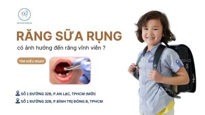RĂNG SỮA RỤNG SỚM ẢNH HƯỞNG NHƯ THẾ NÀO ĐẾN RĂNG VĨNH VIỄN?