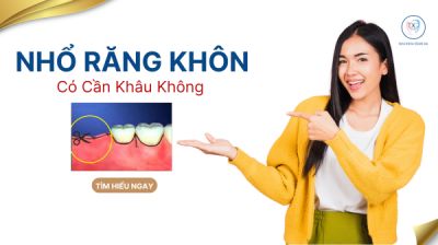 NHỔ RĂNG KH&Ocirc;N C&Oacute; CẦN KH&Acirc;U KH&Ocirc;NG ?