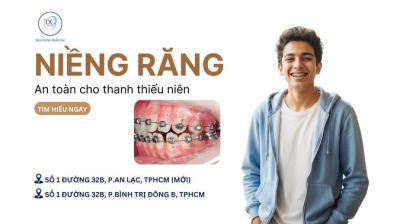 NIỀNG MẮC CÀI CÁNH CAM – SỰ LỰA CHỌN AN TOÀN CHO THANH THIẾU NIÊN