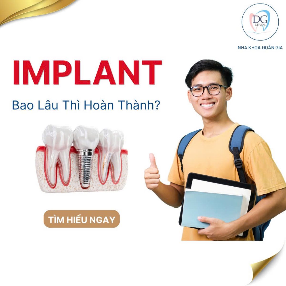 TRỒNG IMPLANT BAO L&Acirc;U TH&Igrave; L&Agrave;NH ?