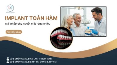 IMPLANT TOÀN HÀM – GIẢI PHÁP CHO NGƯỜI MẤT RĂNG NHIỀU