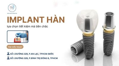 CẤY GHÉP IMPLANT HÀN QUỐC – LỰA CHỌN TIẾT KIỆM MÀ BỀN CHẮC