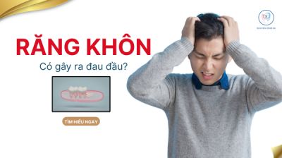 RĂNG KH&Ocirc;N L&Agrave;M ĐAU ĐẦU ?