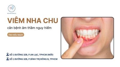 VIÊM NHA CHU – CĂN BỆNH ÂM THẦM NGUY HIỂM CHO RĂNG MIỆNG