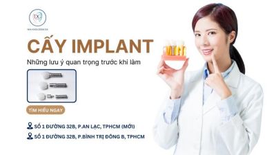 NHỮNG LƯU Ý QUAN TRỌNG TRƯỚC KHI CẤY GHÉP IMPLANT