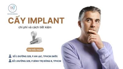 CHI PHÍ CẤY IMPLANT – YẾU TỐ ẢNH HƯỞNG VÀ CÁCH TIẾT KIỆM