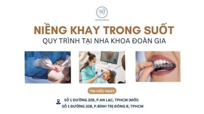 QUY TRÌNH NIỀNG KHAY VÀ THỜI GIAN BAO LÂU