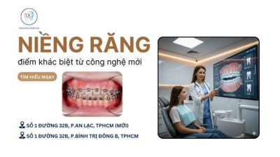 NIỀNG MẮC CÀI CÁNH CAM – ĐIỂM KHÁC BIỆT TỪ CÔNG NGHỆ MỚI