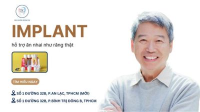 IMPLANT HỖ TRỢ CHỨC NĂNG ĂN NHƯ RĂNG THẬT