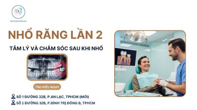 NHỔ RĂNG KH&Ocirc;N LẦN 2 &ndash; T&Acirc;M L&Yacute; V&Agrave; CHĂM S&Oacute;C SAU KHI NHỔ RĂNG
