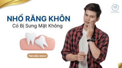 NHỔ RĂNG KH&Ocirc;N C&Oacute; BỊ SƯNG MẶT KH&Ocirc;NG ?