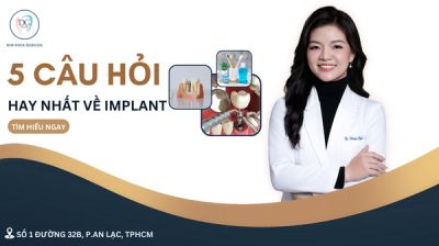 5 CÂU HỎI HAY NHẤT VỀ TRỒNG RĂNG IMPLANT – GIẢI ĐÁP TỪ CHUYÊN GIA