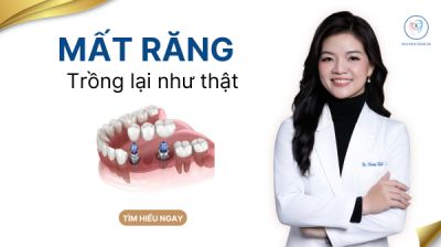 MẤT RĂNG L&Acirc;U NĂM C&Oacute; TRỒNG IMPLANT ĐƯỢC KH&Ocirc;NG?