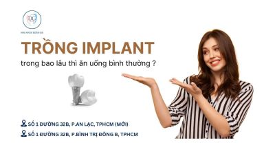 TRỒNG IMPLANT TRONG BAO LÂU THÌ ĂN UỐNG BÌNH THƯỜNG?